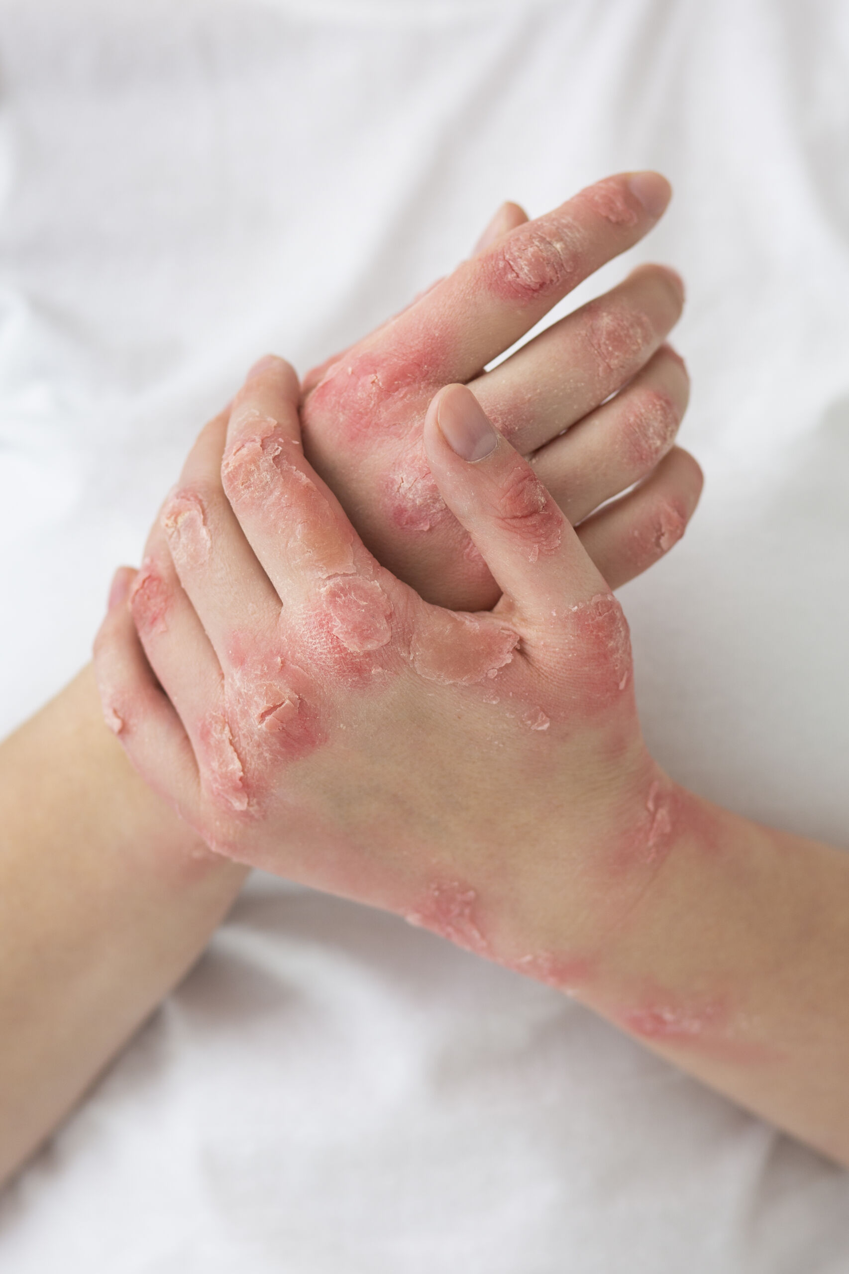 Controindicazioni assolute dei massaggi